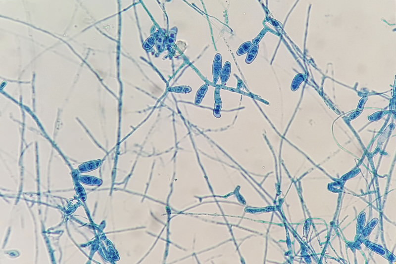 Dermatophyten, Epidermophyton, Fadenpilze, Microsporum, Trichophyton