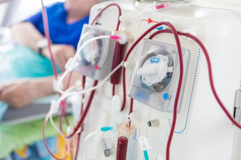 Dialyse Behandlung: Definition, Vorgehen und Risiken | eMEDI