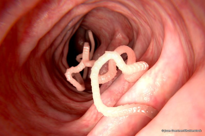 Parasiten im Körper des Menschen Parasiten im Körper des Menschen