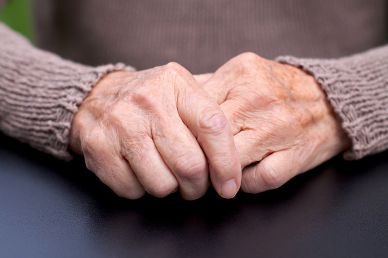 Morbus Parkinson Morbus Parkinson, Paralysis agitans, Parkinson-Krankheit, Parkinson-Syndrom, Schüttellähmung