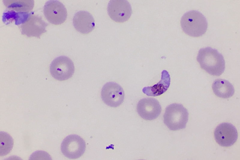 Plasmodium