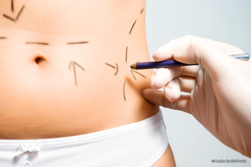 Plastische Chirurgie