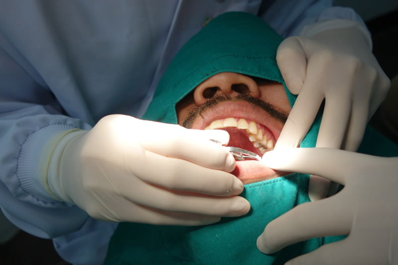 Wurzelbehandlung, Endodontische Behandlung, Wurzelkanalbehandlung