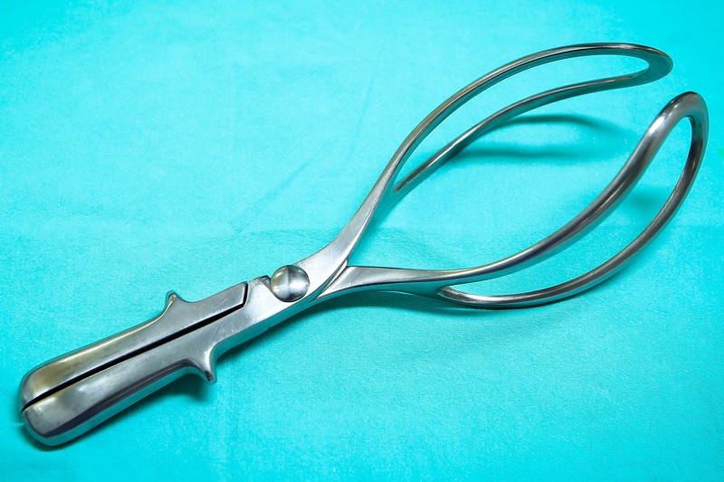 Zangengeburt, Forceps, Forcepsextraktion, Geburtszange